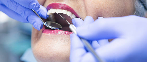 Best Emergency Root Canal Treatment in Prospect Park, NJ